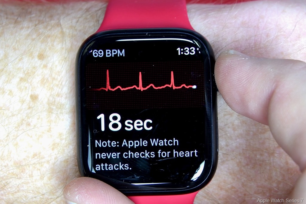 ego shilling Usikker First Look at Garmin's ECG Functionality, and Clinical Trials Details | DC  Rainmaker