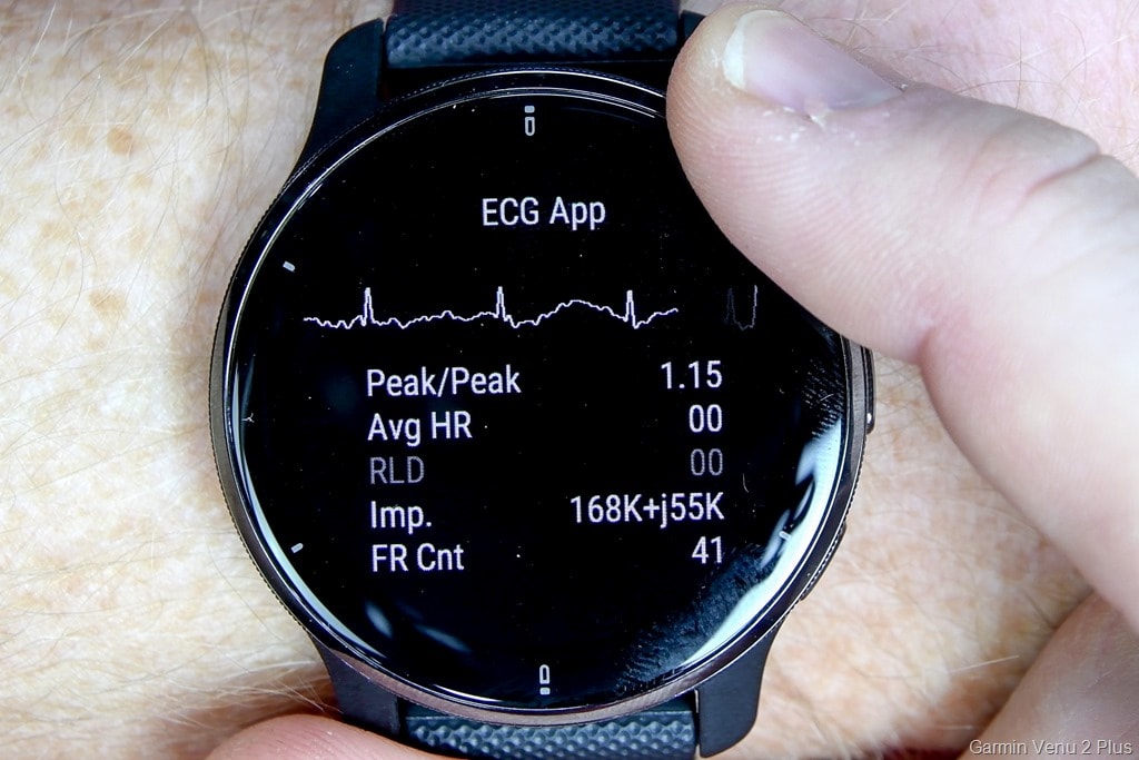 Look at Garmin's Functionality, and Clinical Trials Details | Rainmaker
