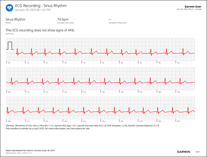 Fitbit Receives Regulatory Clearance in Both the United States and Europe  for ECG App to Identify Atrial Fibrillation (AFib)