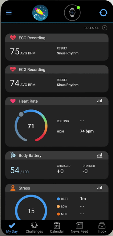 Garmin ECG Feature Is Live: Here's how works! | DC Rainmaker