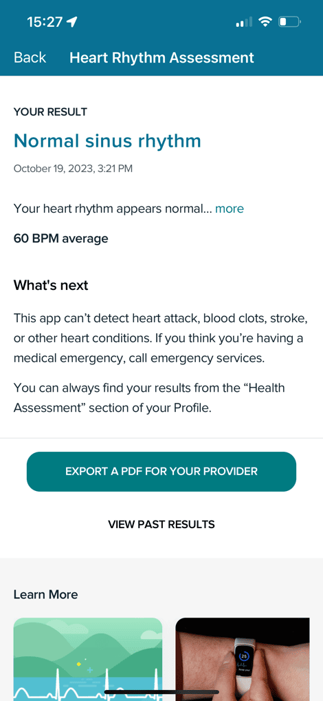 FitbitCharge6ECGDownload