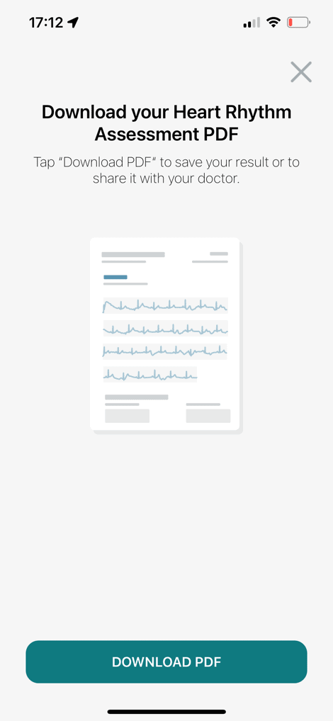 FitbitCharge6ECGDownload