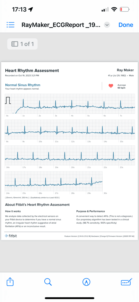 Fitbit Charge 6: How to Use the ECG Feature 