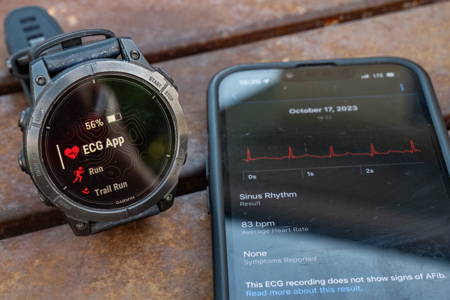 How to use Garmin ECG Feature Fenix 7 Pro, Epix Pro, and Venu 3 DC